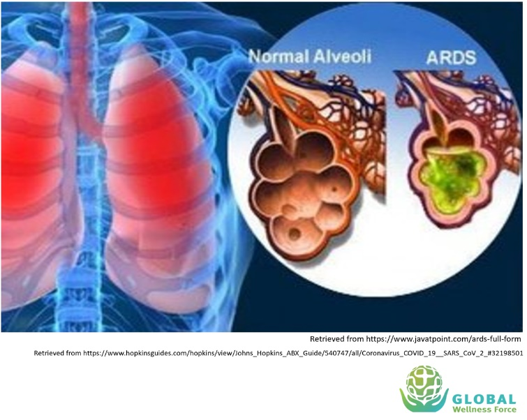 Knowledge Center Cvd Treatment